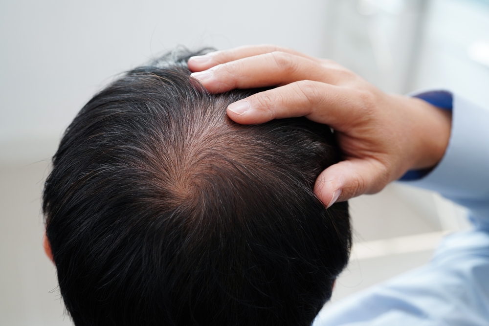Hair loss & skin changes